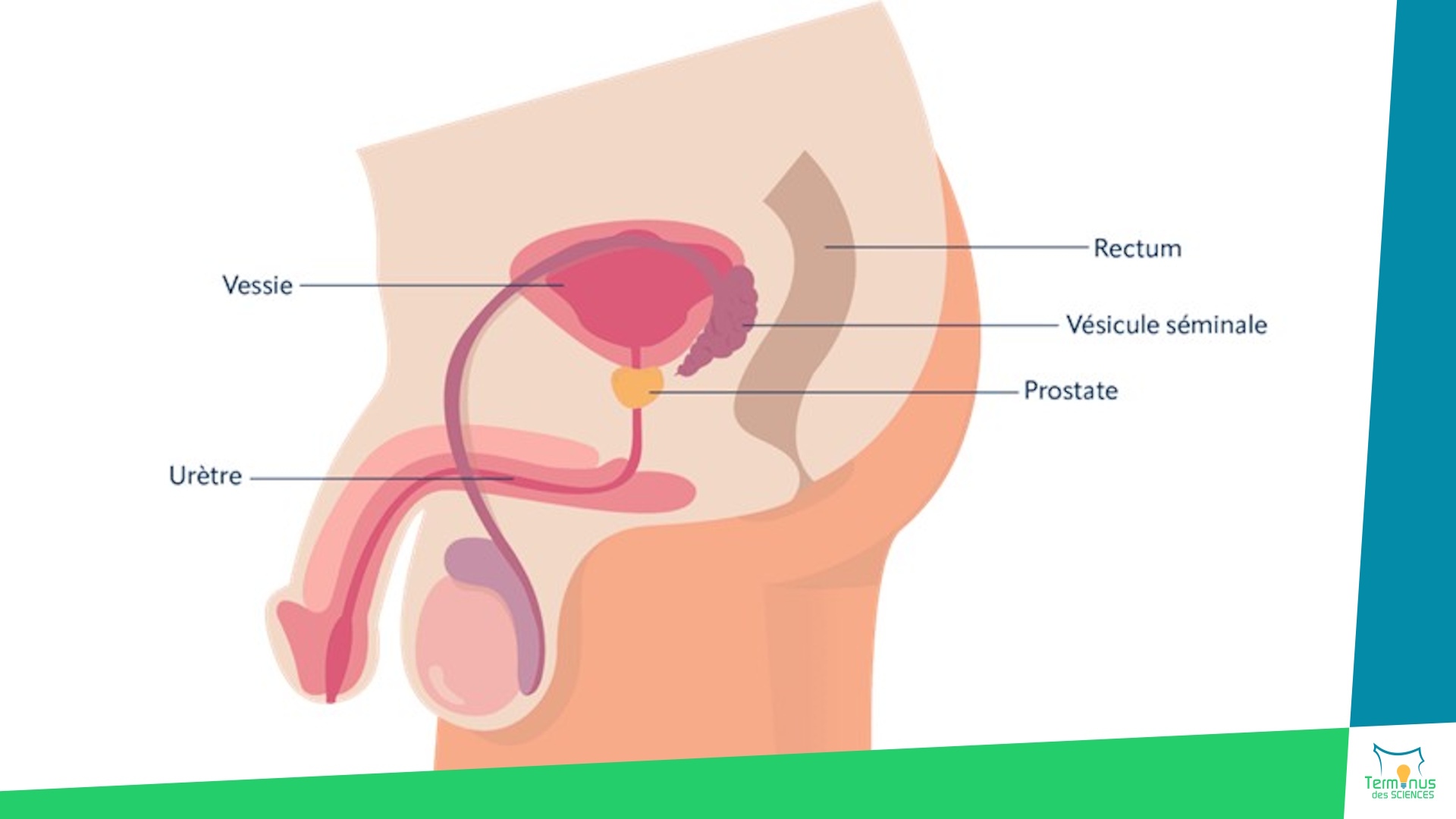 Lire la suite à propos de l’article [Le diagnostic du cancer de la prostate : vers des approches plus précises et personnalisées]